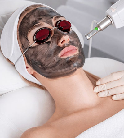 Laser Treatments