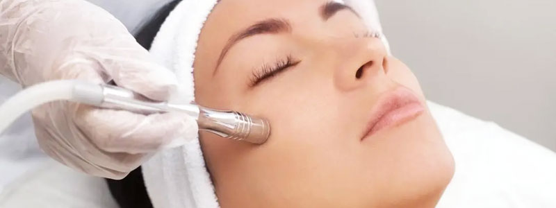 Microdermabrasion