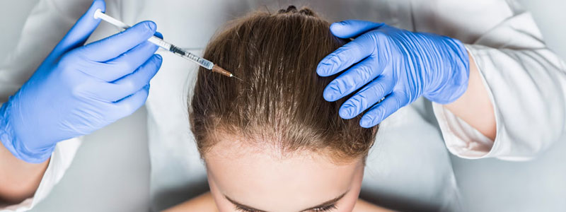 Botox for Hair Loss