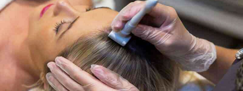 Microneedling for Hair