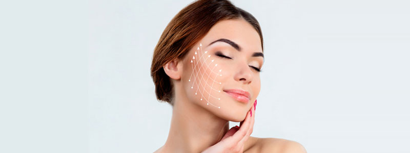 Threadlift