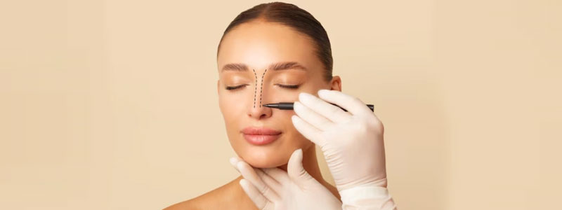 Rhinoplasty